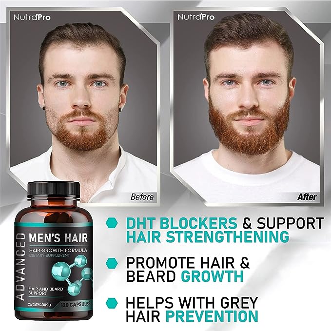 NutraPro Hair Growth Vitamins For Men Review